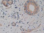 alpha Actinin 4 Antibody in Immunohistochemistry (Paraffin) (IHC (P))