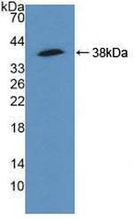 alpha Actinin 4 Antibody in Western Blot (WB)