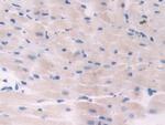 ADCY6 Antibody in Immunohistochemistry (Paraffin) (IHC (P))