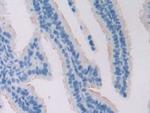 ADCY6 Antibody in Immunohistochemistry (Paraffin) (IHC (P))