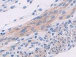 ADCY6 Antibody in Immunohistochemistry (Paraffin) (IHC (P))