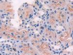 ADCY6 Antibody in Immunohistochemistry (Paraffin) (IHC (P))