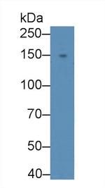 ADCY6 Antibody in Western Blot (WB)