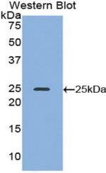 Alcohol Dehydrogenase 1A Antibody in Western Blot (WB)