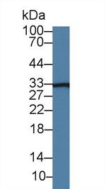 AK1BA Antibody in Western Blot (WB)