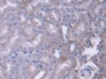 alpha Adducin Antibody in Immunohistochemistry (Paraffin) (IHC (P))