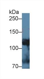 alpha Adducin Antibody in Western Blot (WB)