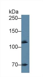 alpha Adducin Antibody in Western Blot (WB)