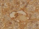 alpha-1 Antitrypsin Antibody in Immunohistochemistry (Paraffin) (IHC (P))