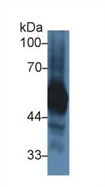 alpha-1 Antitrypsin Antibody in Western Blot (WB)