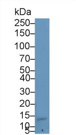 AHSP Antibody in Western Blot (WB)