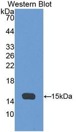 AHSP Antibody in Western Blot (WB)