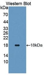 Angiogenin Antibody in Western Blot (WB)