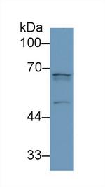 Angiopoietin 2 Antibody in Western Blot (WB)