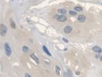 ANTXR2 Antibody in Immunohistochemistry (Paraffin) (IHC (P))