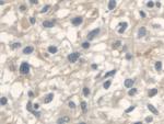 ANTXR2 Antibody in Immunohistochemistry (Paraffin) (IHC (P))