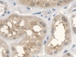 ANTXR2 Antibody in Immunohistochemistry (Paraffin) (IHC (P))