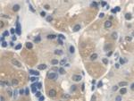 ANTXR2 Antibody in Immunohistochemistry (Paraffin) (IHC (P))