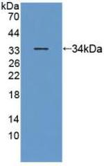 ANTXR2 Antibody in Western Blot (WB)