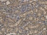 APOB Antibody in Immunohistochemistry (Paraffin) (IHC (P))