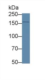 APOB Antibody in Western Blot (WB)