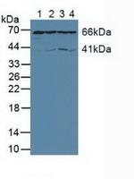 AIF Antibody in Western Blot (WB)