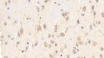 Artemin Antibody in Immunohistochemistry (Paraffin) (IHC (P))