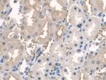 BMAL1 Antibody in Immunohistochemistry (Paraffin) (IHC (P))