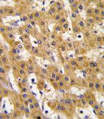 PDX1 Antibody in Immunohistochemistry (Paraffin) (IHC (P))