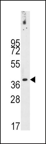 PDX1 Antibody in Western Blot (WB)