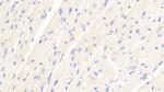 ABCD2 Antibody in Immunohistochemistry (Paraffin) (IHC (P))