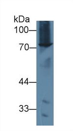 ABCD2 Antibody in Western Blot (WB)