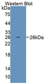 ABCD2 Antibody in Western Blot (WB)