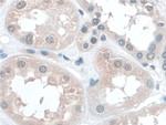 BANF1 Antibody in Immunohistochemistry (Paraffin) (IHC (P))