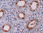 Bcl-2 Antibody in Immunohistochemistry (Paraffin) (IHC (P))