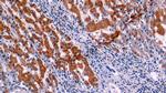 Bcl-2 Antibody in Immunohistochemistry (Paraffin) (IHC (P))