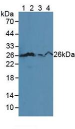 Bcl-2 Antibody in Western Blot (WB)