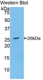 Bcl-2 Antibody in Western Blot (WB)