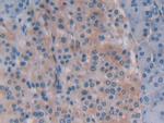 Beclin 1 Antibody in Immunohistochemistry (Paraffin) (IHC (P))