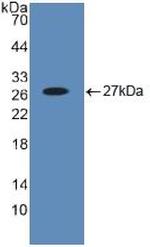 BID Antibody in Western Blot (WB)