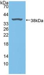 Biliverdin Reductase Antibody in Western Blot (WB)