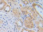 ZNF179 Antibody in Immunohistochemistry (Paraffin) (IHC (P))