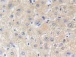 ZNF179 Antibody in Immunohistochemistry (Paraffin) (IHC (P))