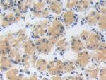 ZNF179 Antibody in Immunohistochemistry (Paraffin) (IHC (P))