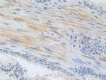 ZNF179 Antibody in Immunohistochemistry (Paraffin) (IHC (P))