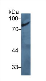 ZNF179 Antibody in Western Blot (WB)