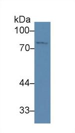 ZNF179 Antibody in Western Blot (WB)