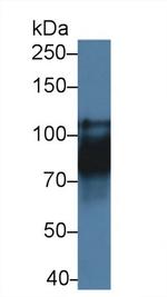 CDH16 Antibody in Western Blot (WB)