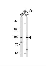 PROX1 Antibody in Western Blot (WB)