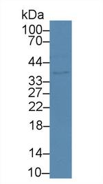 Calumenin Antibody in Western Blot (WB)